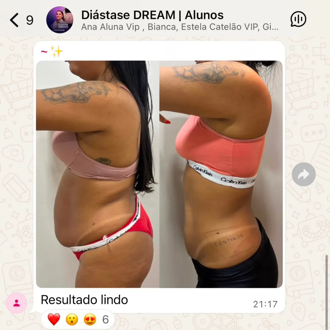 Depoimento de aluna do Diástase Dream