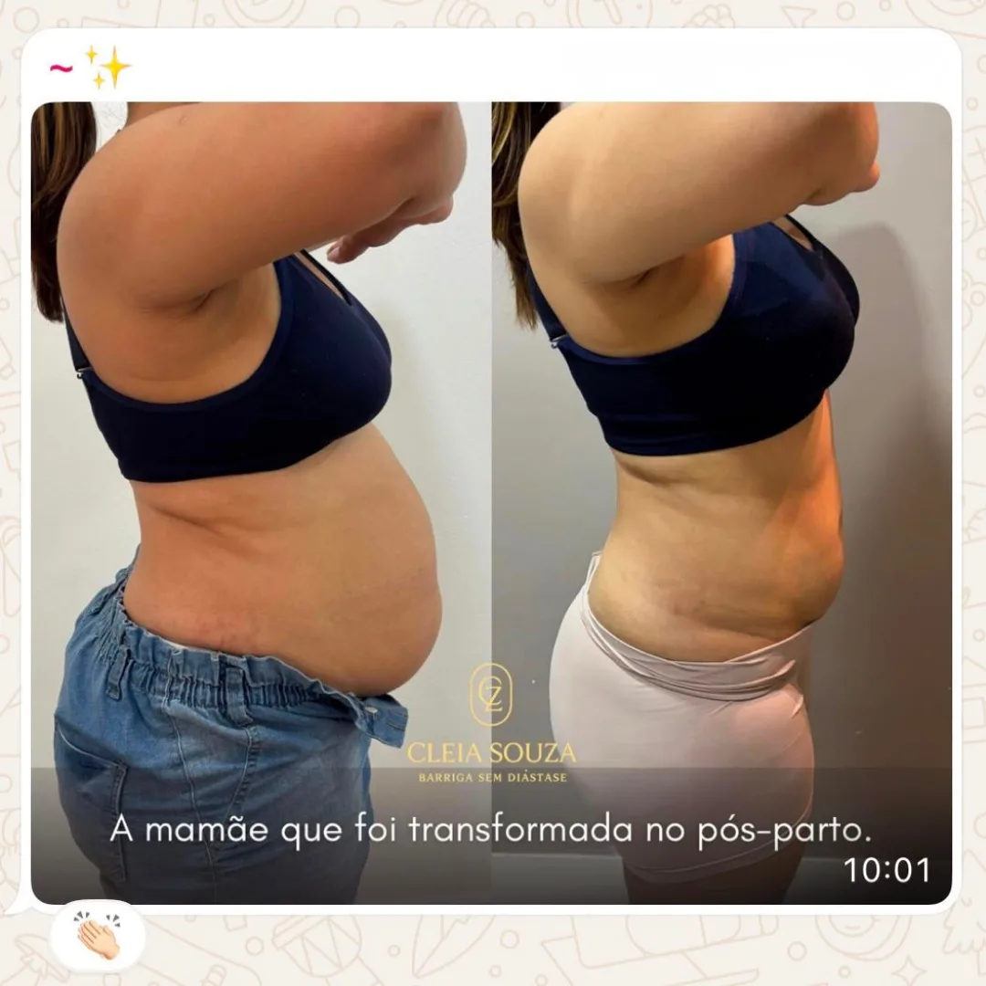 Depoimento de aluna do Diástase Dream