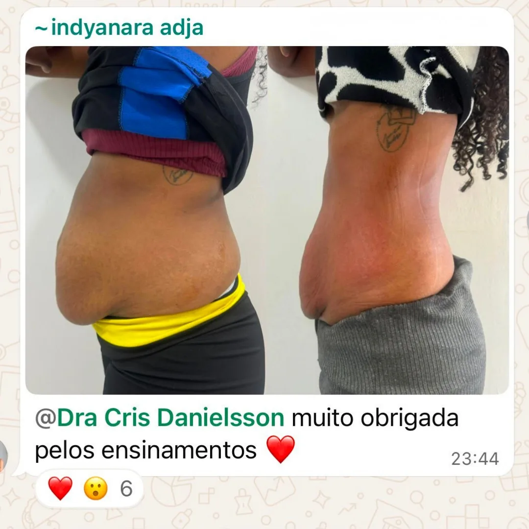 Depoimento de aluna do Diástase Dream