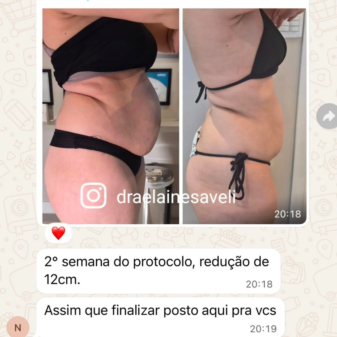 Depoimento de aluna do Diástase Dream