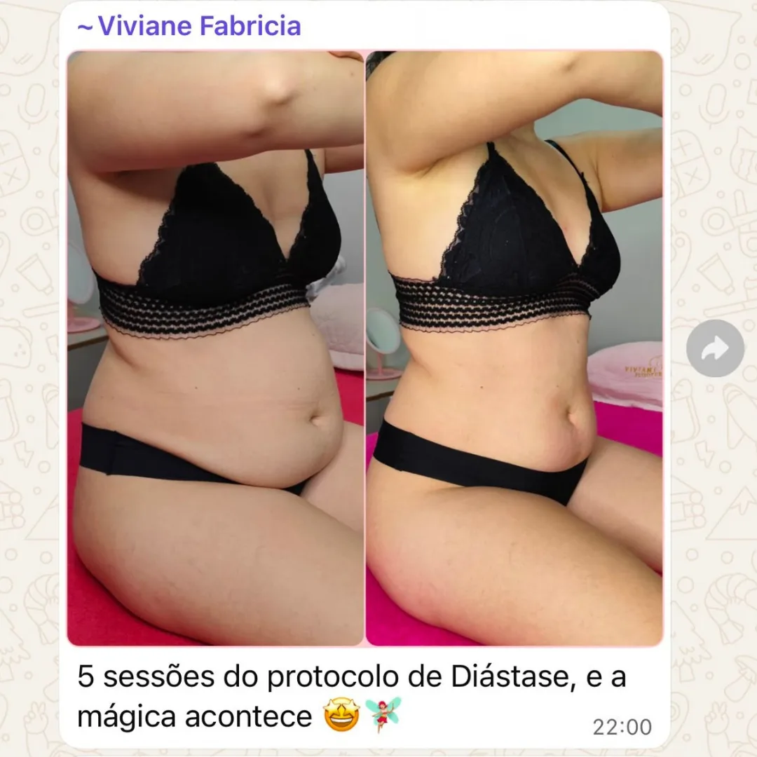Depoimento de aluna do Diástase Dream