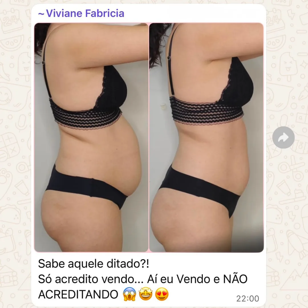 Depoimento de aluna do Diástase Dream